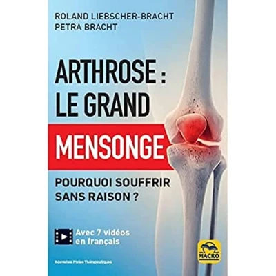 Afbeelding van Arthrose : le grand mensonge