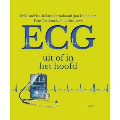 Afbeelding van ECG