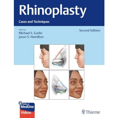 Afbeelding van Rhinoplasty: Cases And Techniques
