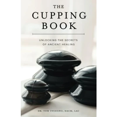 Afbeelding van The Cupping Book