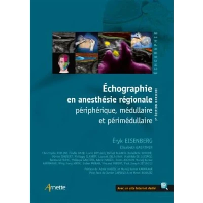Image de Echographie en anesthésie régionale