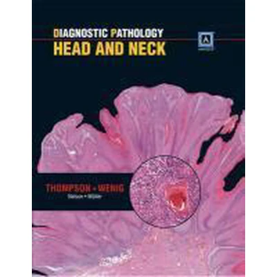 Afbeelding van Diagnostic Pathology: Head and Neck