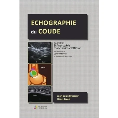 Afbeelding van Echographie du coude