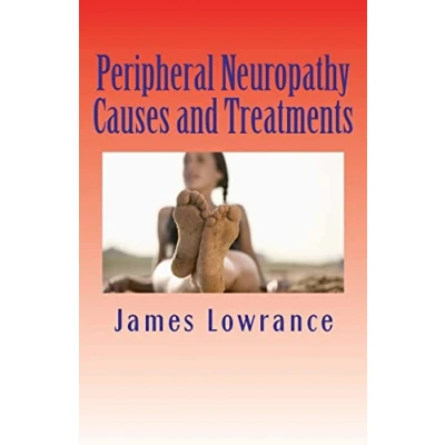 Afbeelding van Peripheral Neuropathy Causes and Treatments