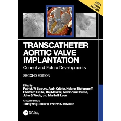 Afbeelding van Transcatheter Aortic Valve Implantation