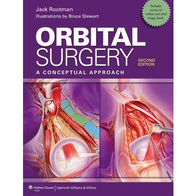 Afbeelding van Orbital Surgery