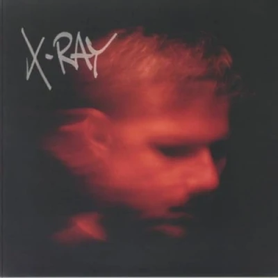Afbeelding van Murdock X Ray (2 LPs)