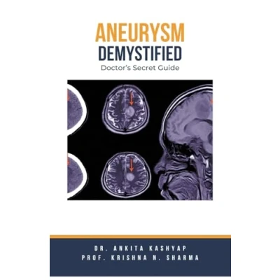 Afbeelding van Aneurysm Demystified: Doctor&#039;s Secret Guide