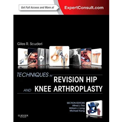 Afbeelding van Techniques In Revision Hip &amp; Knee Arthro