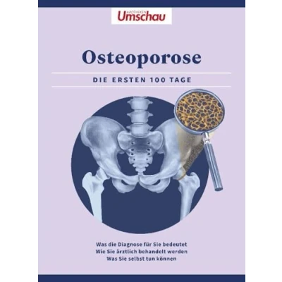 Afbeelding van Apotheken Umschau: Osteoporose: die ersten 100 Tage. Was Diagnose bedeutet Wie Sie ärztlich behandelt werden selbst tun können (Die Buchreihe der Umschau