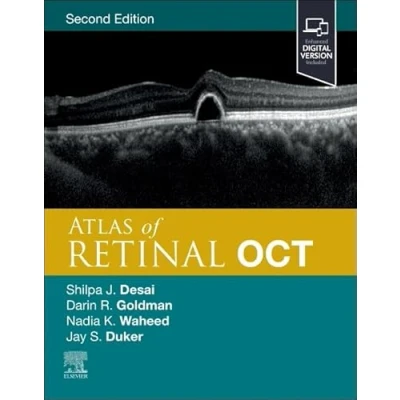 Afbeelding van Atlas of Retinal OCT