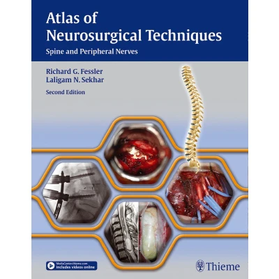 Afbeelding van Atlas of Neurosurgical Techniques Spine and Peripheral Nerves