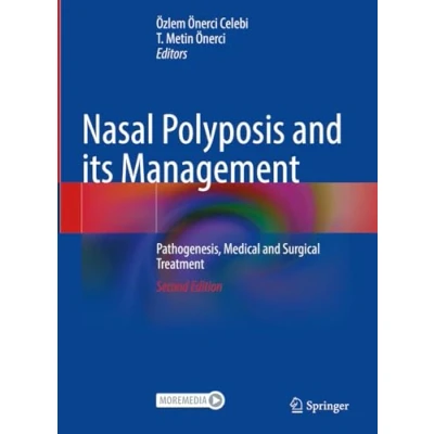 Afbeelding van Nasal Polyposis and its Management