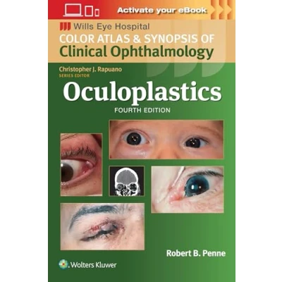 Afbeelding van Wills Eye Institute Atlas Series Oculoplastics