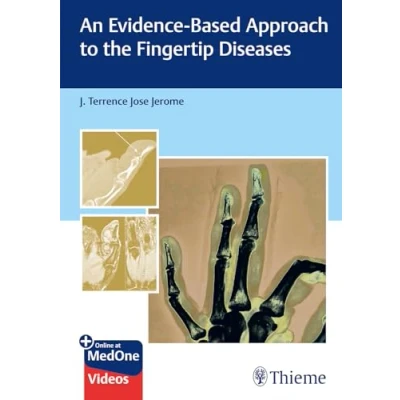 Afbeelding van An Evidence Based Approach to the Fingertip Diseases