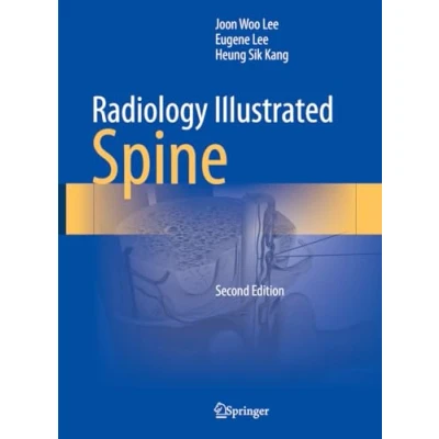 Afbeelding van Radiology Illustrated Illustrated: Spine