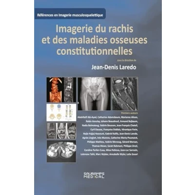 Afbeelding van Imagerie du rachis et des maladies osseuses constitutionnelles