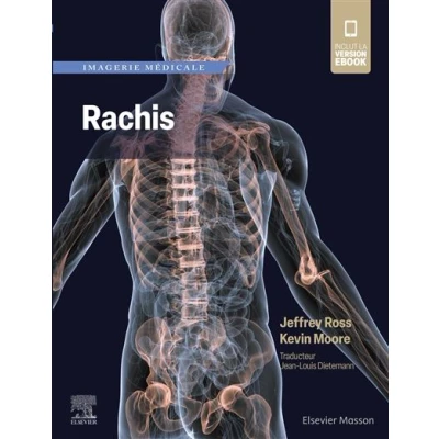 Image de Imagerie médicale : Rachis