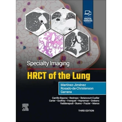 Afbeelding van Specialty Imaging: HRCT of the Lung