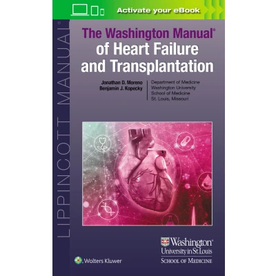 Afbeelding van The Washington Manual of Heart Failure and Transplantation