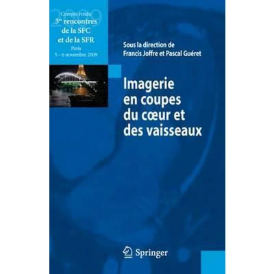 Afbeelding van Imagerie En Coupes Du Coeur Et Des Vaisseaux