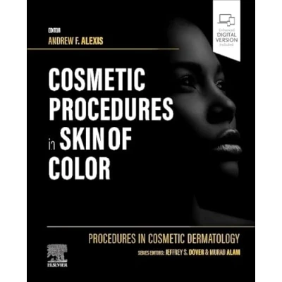 Afbeelding van Procedures in Cosmetic Dermatology: Skin of Color
