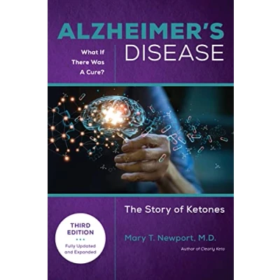Afbeelding van Alzheimer&#039;s Disease