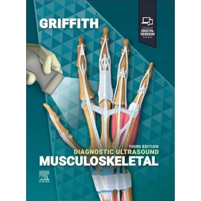 Afbeelding van Diagnostic Ultrasound: Musculoskeletal