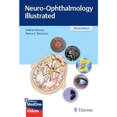 Afbeelding van Neuro Ophthalmology Illustrated