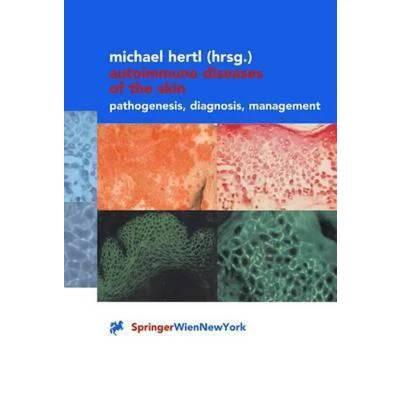Afbeelding van Autoimmune Diseases of the Skin