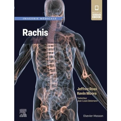 Afbeelding van IMAGERIE MEDICALE RACHIS