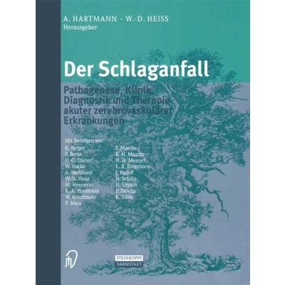 Afbeelding van Der Schlaganfall