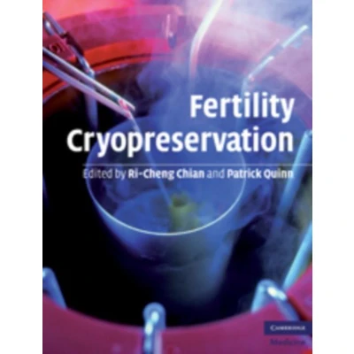 Afbeelding van Fertility Cryopreservation