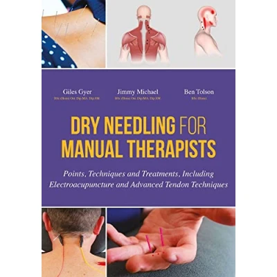 Afbeelding van Dry Needling For Manual Therapists