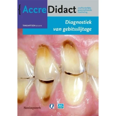 Afbeelding van Diagnostiek van gebitsslijtage