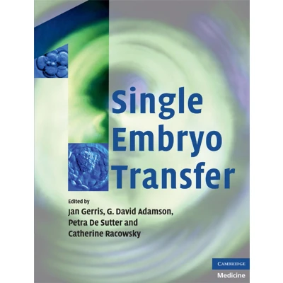 Afbeelding van Single Embryo Transfer