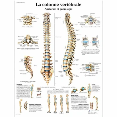 Afbeelding van 3B Scientific VR2152L anatomisch bord, wervelkolom, anatomie en pathologie