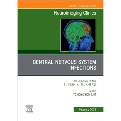 Afbeelding van Central Nervous System Infections, An Issue of Neuroimaging Clinics North America
