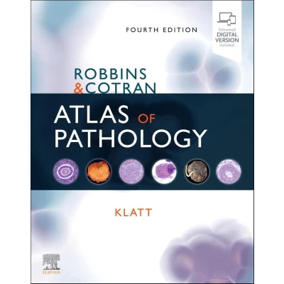 Afbeelding van Robbins and Cotran Atlas of Pathology