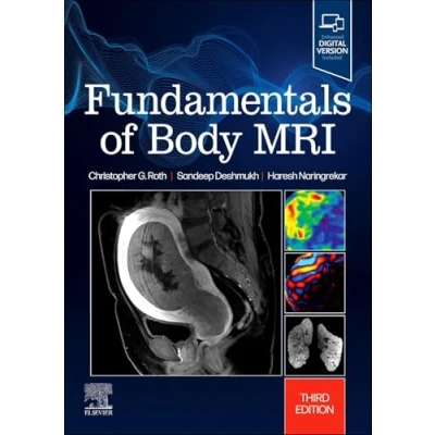 Afbeelding van Fundamentals of Body MRI