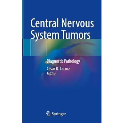 Afbeelding van Central Nervous System Tumors