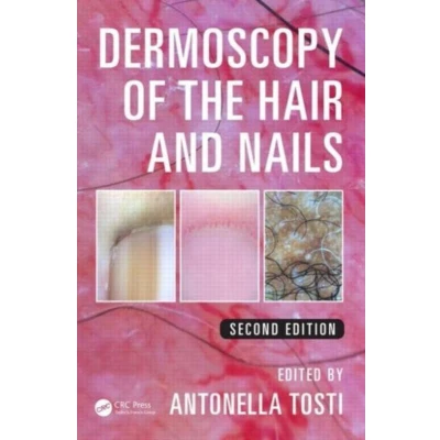 Afbeelding van Dermoscopy of the Hair and Nails