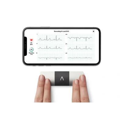 Afbeelding van Kardia Mobile 6 kanaals ECG monitor