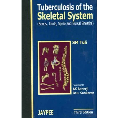 Afbeelding van Tuberculosis of the Skeletal System