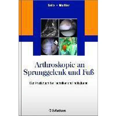 Afbeelding van Arthroskopie an Sprunggelenk und Fuß