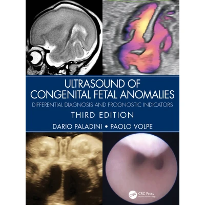 Afbeelding van Ultrasound of Congenital Fetal Anomalies