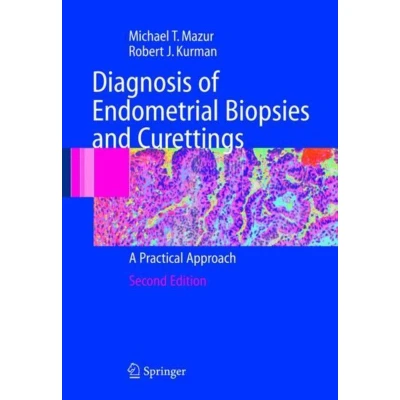 Afbeelding van Diagnosis of Endometrial Biopsies and Curettings
