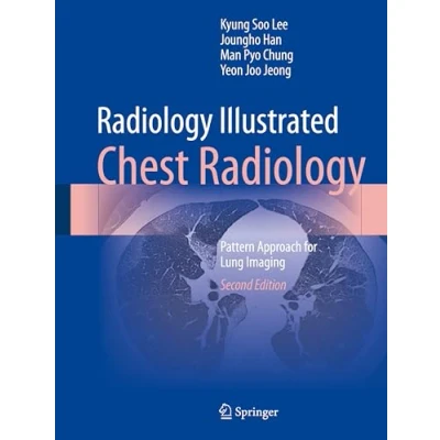 Afbeelding van Radiology Illustrated Illustrated: Chest