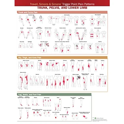 Afbeelding van Travell, Simons &amp; Simons’ Trigger Point Pain Patterns Wall Chart
