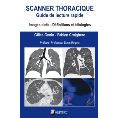 Image de Scanner thoracique. guide de lecture rapide